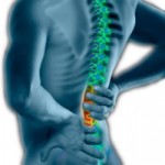 How to Treat Pinched Nerve on your Lower Back