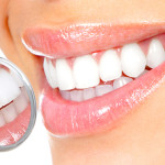 Teeth Whitening Treatment at Home – Yellow Teeth Natural Cure